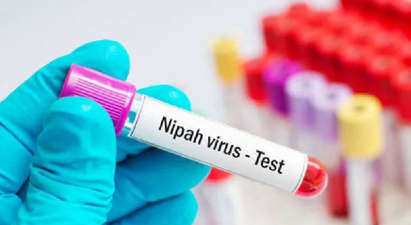 Nipah Virus Test