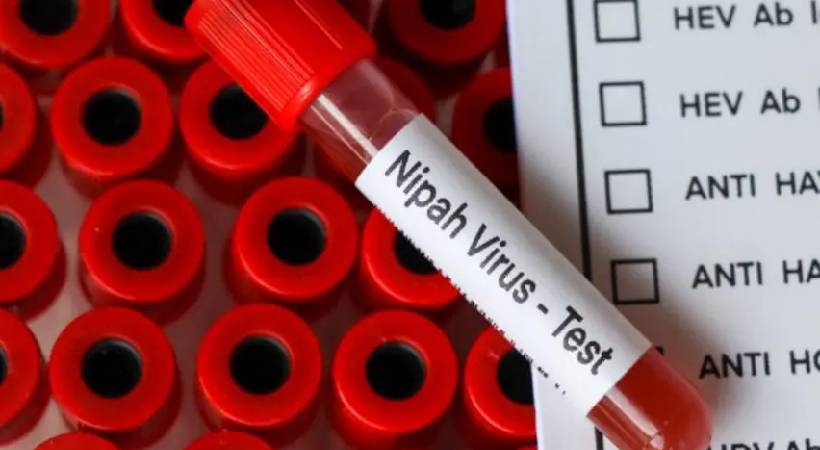 Nipah Virus Test