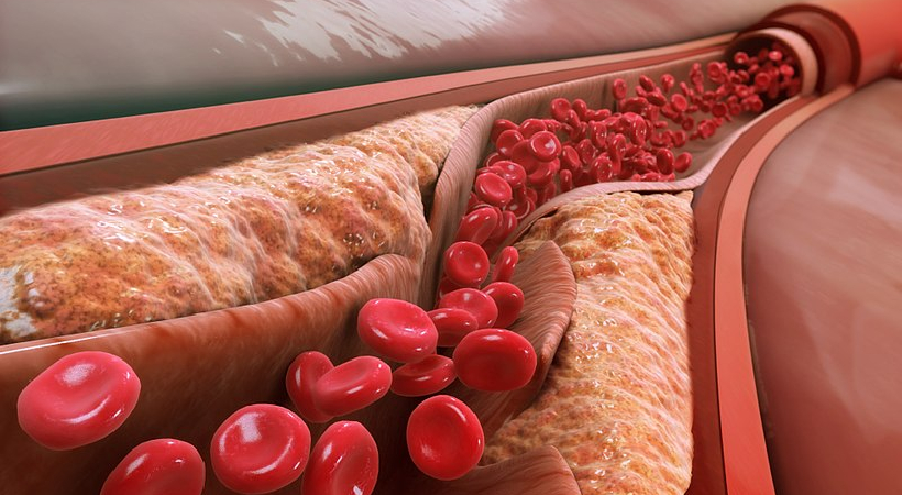 Lipoprotein cholesterol